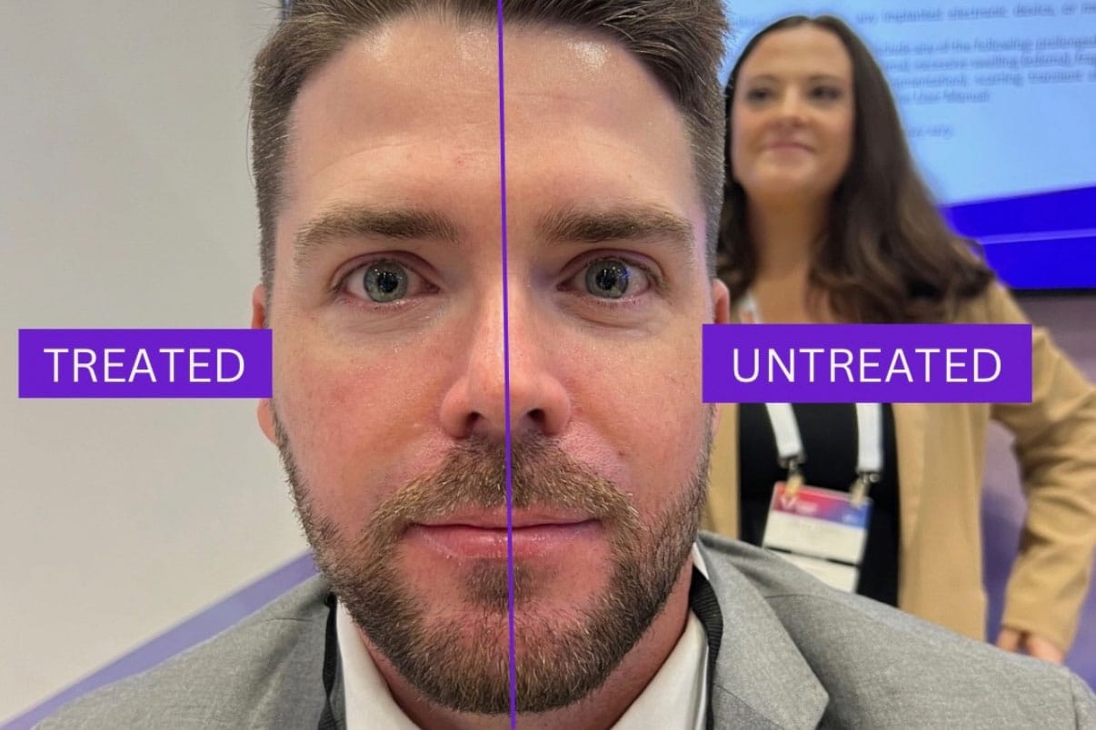 Co Management of  LASIK and Refractive Surgery